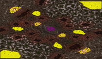 Grinding Teeth (6) full-resolution render